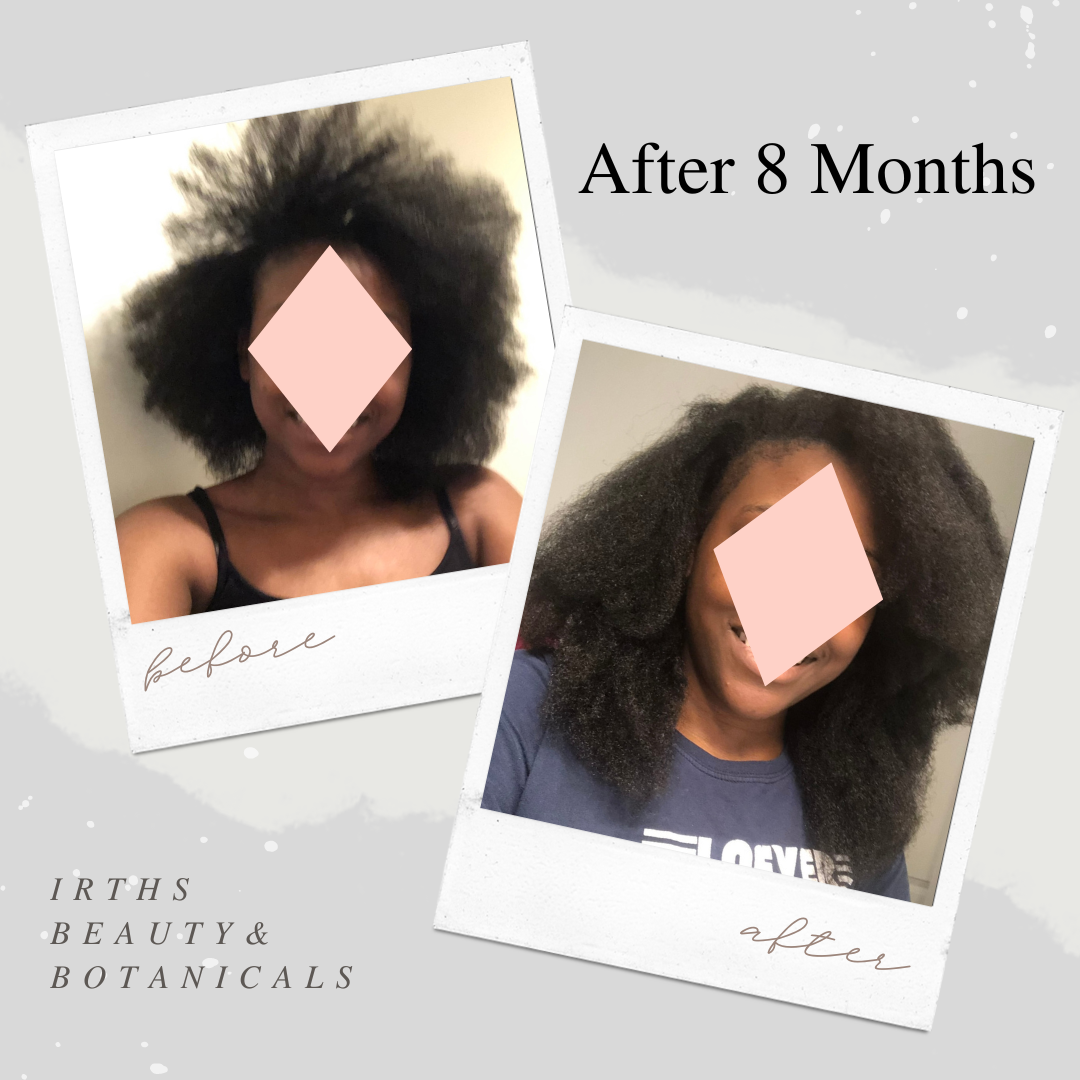 Irth's Beauty & Botanicals Hair Growth Stimulator